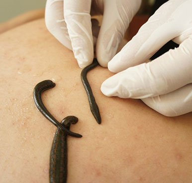 Leech History